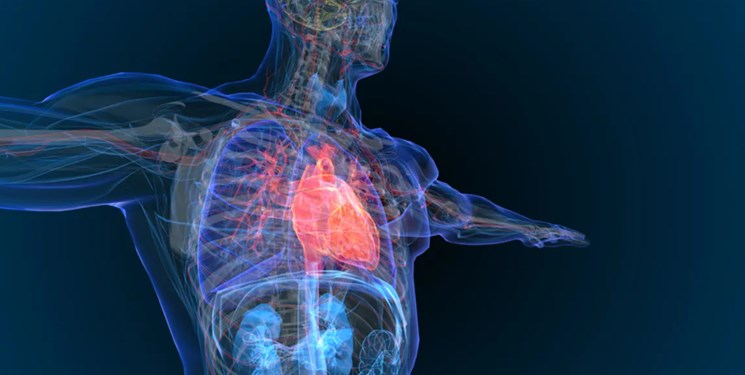 14020403000248 Test PhotoN