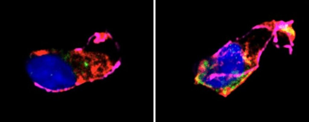 کمتر از 7 ساعت خواب شبانه احتمال بیماری قلبی را افزایش می‌دهد