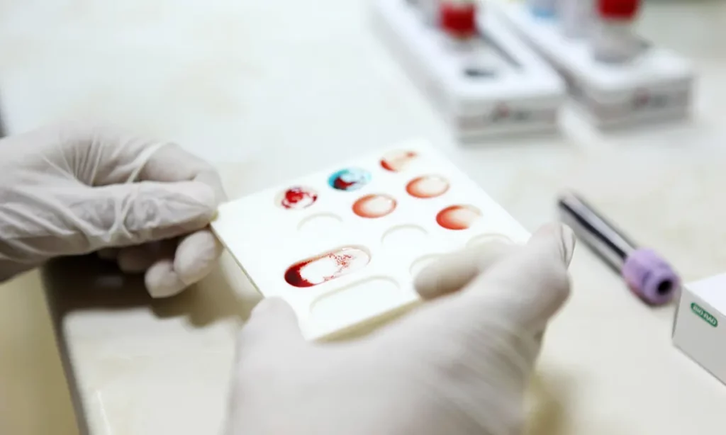 آزمایش خون سریع و ارزانی که ممکن است سرطان را قبل از پیدایش علائم تشخیص دهد 4 آزمایش خون سریع و ارزانی که ممکن است سرطان را.webp