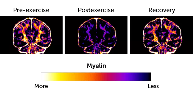 بدن دوندگان ماراتن احتمالاً در طول مسابقه بافت مغزی خود را هم مصرف می‌کند