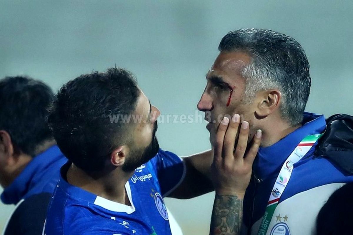 هاشمی نسب با سر خونین آزادی را ترک کرد! (ویدیو)