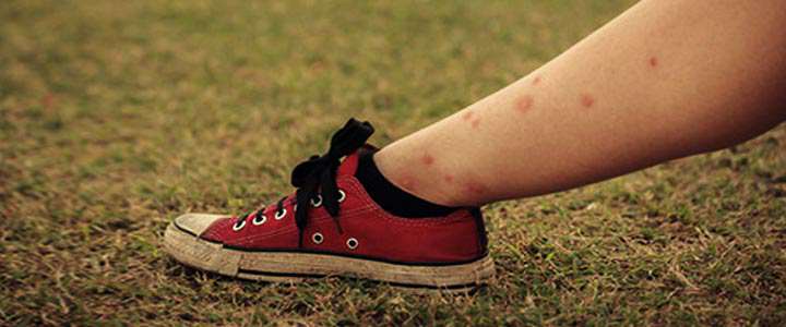 از بین بردن ساس | این حشره از چه چیزی بدش می آید_روشنفکر 14 ساس - علائم گزش ساس