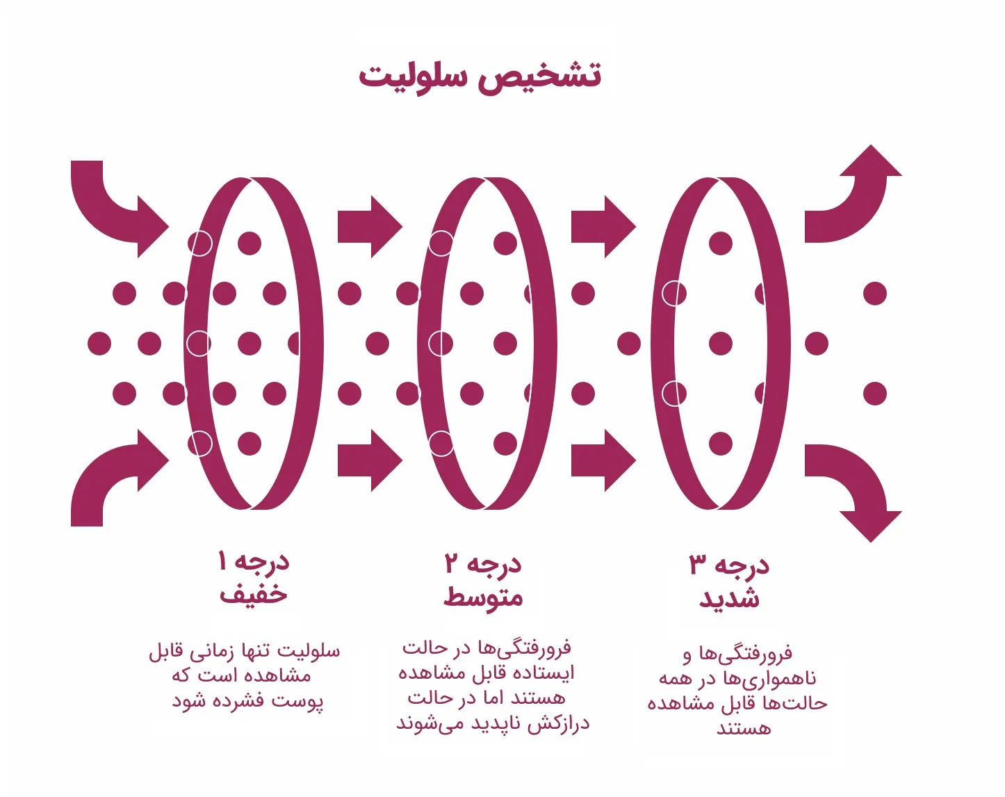 تفاوت لیپیدما و سلولیت: راهنمای تشخیص و درمان_روشنفکر 11 اینفوگرافیک درجهبندی شدت سلولیت