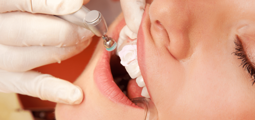 لبخندی که همه چیز رو تغییر میده؛ راهنمای کامل مراقبت و درمان های دندانپزشکی 10 لبخندی که همه چیز رو تغییر میده؛ راهنمای کامل مراقبت و درمان های دندانپزشکی